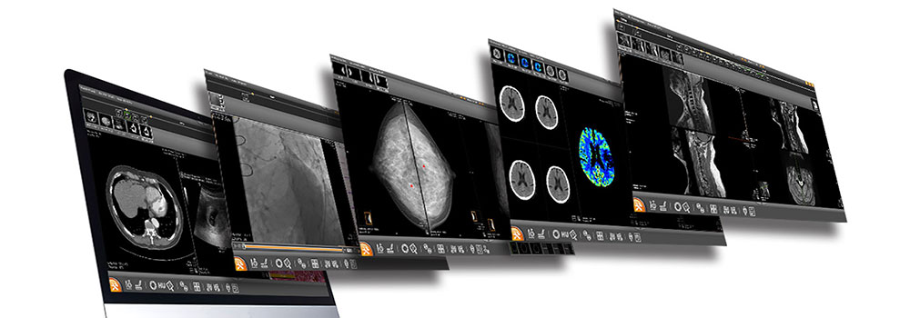 DICOM Viewer Online-on-DigitalDistributionHub