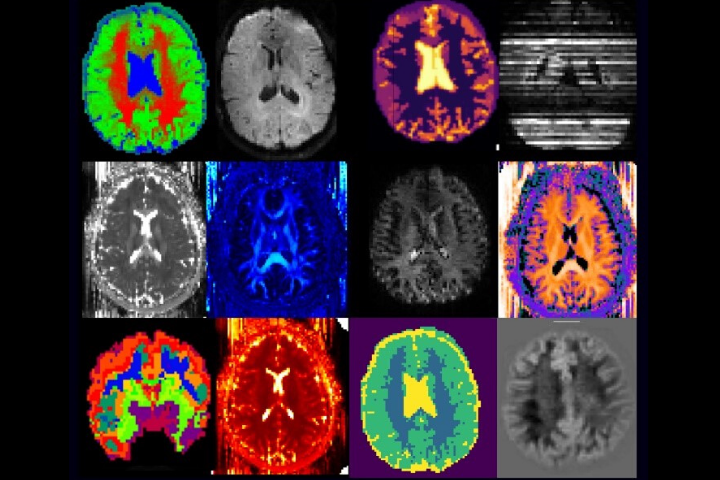 medical imaging data