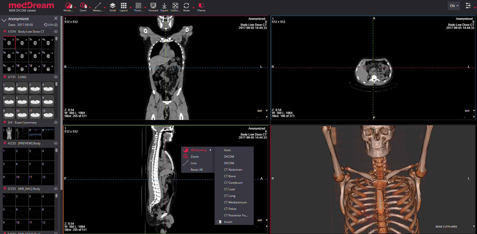 HTML5 DICOM viewer