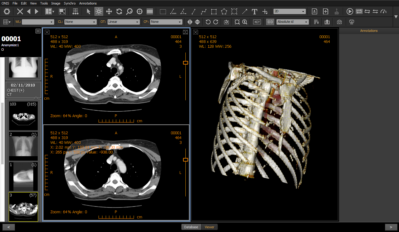 DICOM viewer library