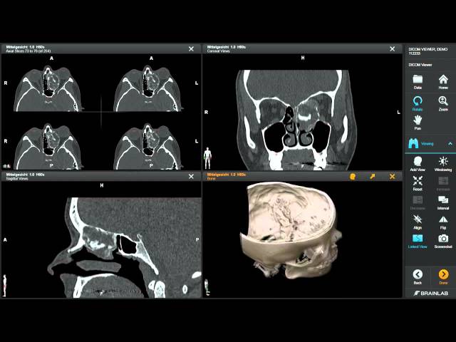 Who Relies Most On A Medical Image Viewer For DICOM-Based Diagnostics? Medical image viewer